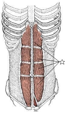 腹直筋.jpg