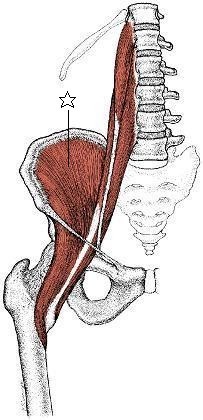 腸骨筋.jpg